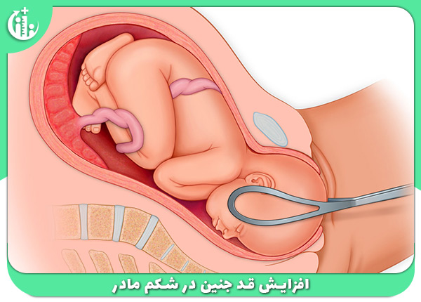 افزایش قد جنین در شکم مادر